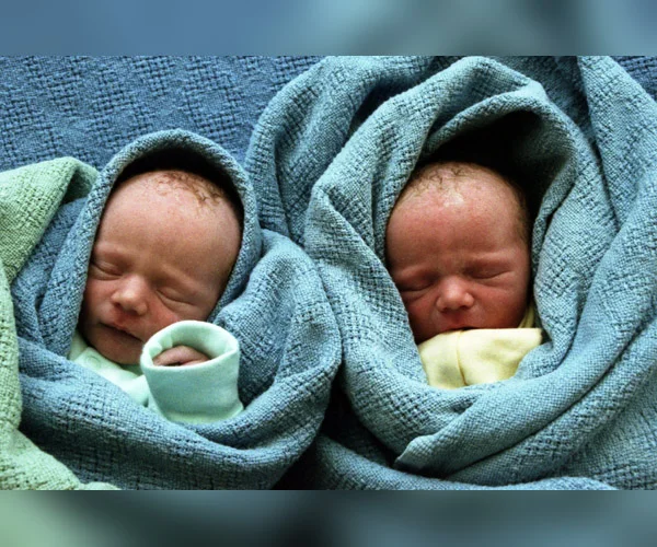 IVF CONCEIVED PREGNANCY AND TWIN PREGNANCY