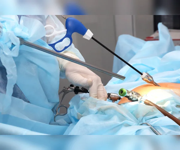 HYSTEROSCOPIC CUT REMOVAL