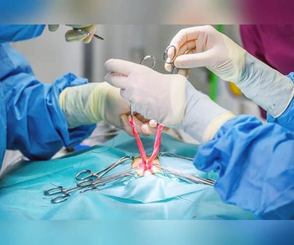 UTERUS REMOVAL SURGERY