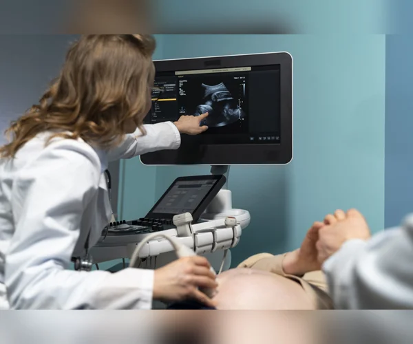 ULTRASOUND SCAN